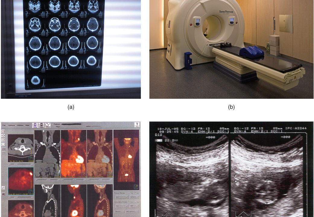 A Scanner That Images the Heart in a Single Beat Goes on the Road
