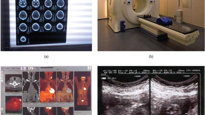 A Scanner That Images the Heart in a Single Beat Goes on the Road
